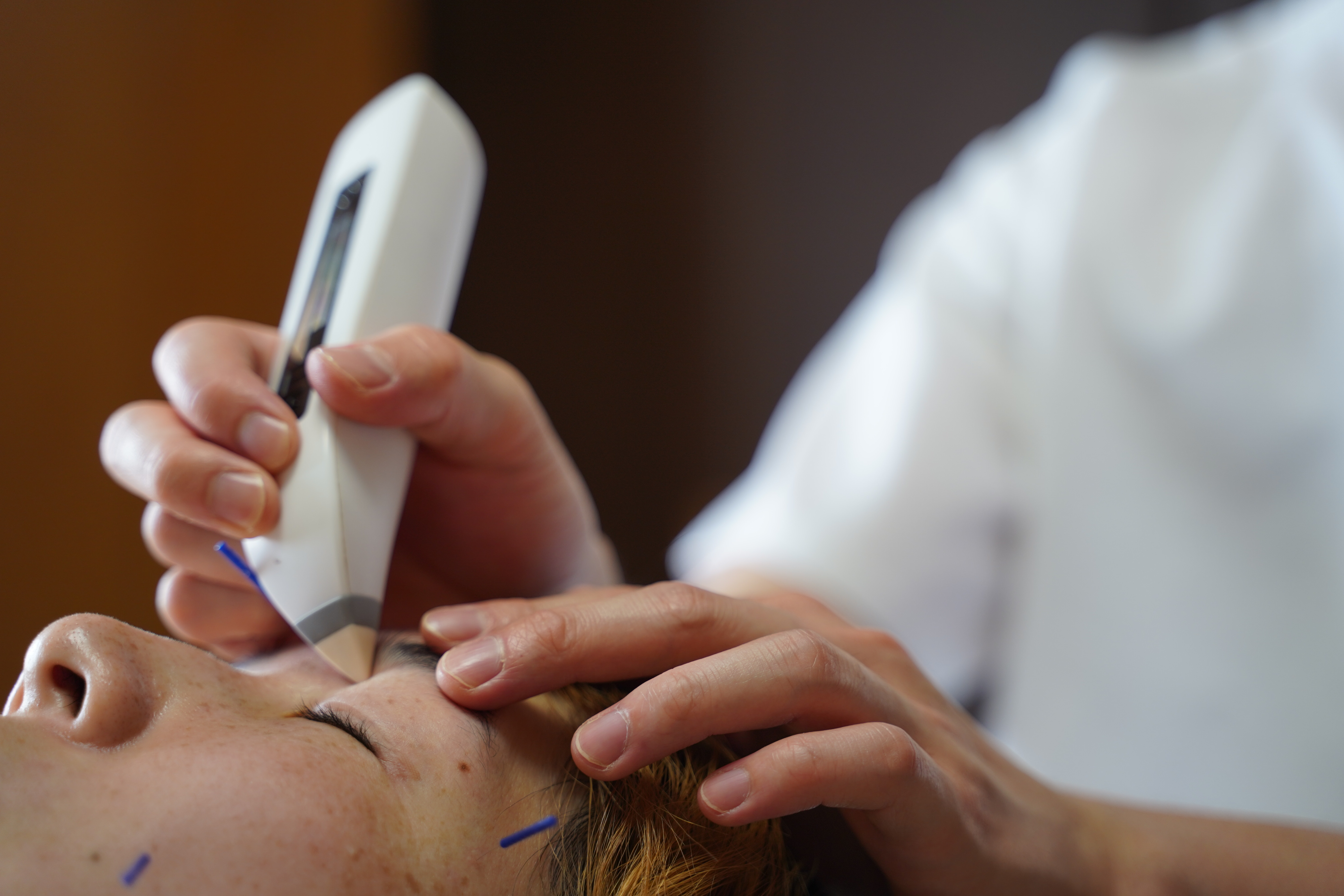 電子温灸器を使用した施術